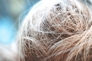 Shampooing cuir chevelu Lausanne